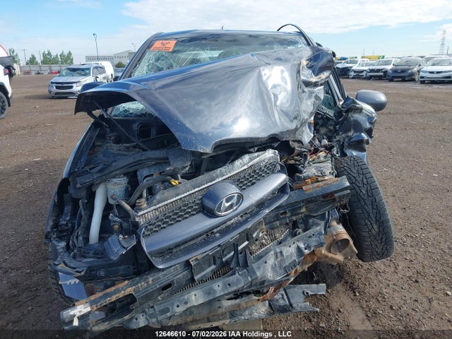 12646610 :رقم المزاد ، KMHCN3BCXBU196981 vin ، 2011 Hyundai Accent L مزاد بيع