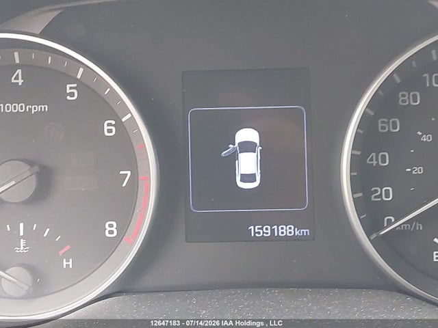 12647183 :رقم المزاد ، KMHD84LF0HU142270 vin ، 2017 Hyundai Elantra Se/value/limited مزاد بيع