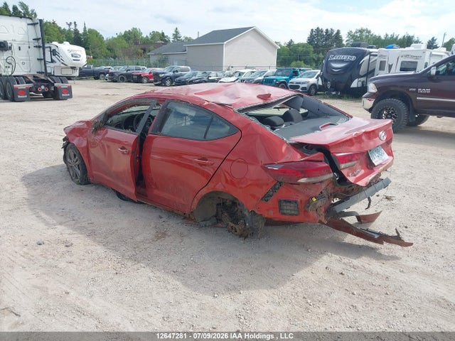 12647281 :رقم المزاد ، KMHD84LF4HU176518 vin ، 2017 Hyundai Elantra Se/value/limited مزاد بيع