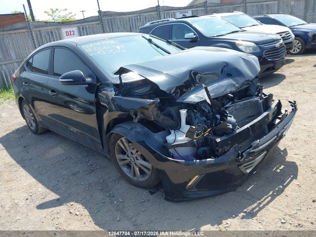 12647704 :رقم المزاد ، KMHD84LF6JU657540 vin ، 2018 Hyundai Elantra مزاد بيع