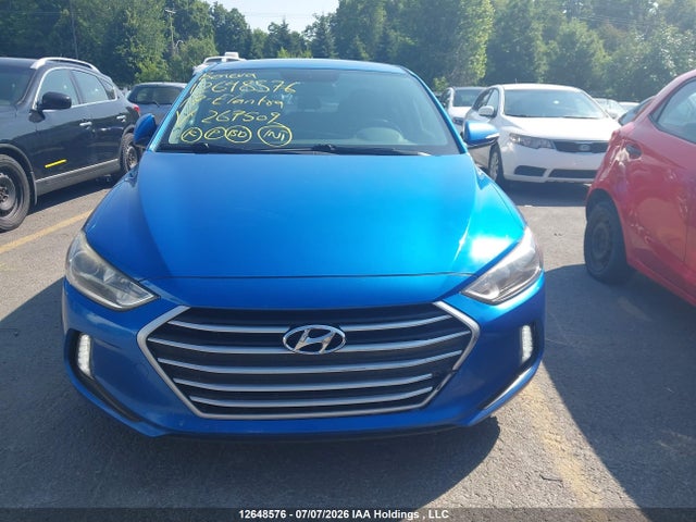 12648576 :رقم المزاد ، KMHD84LF9HU267509 vin ، 2017 Hyundai Elantra Gl مزاد بيع