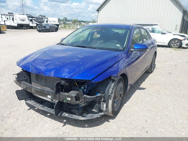 Hyundai ELANTRA SEL 2024 KMHLM4DG6RU801520 Image 2