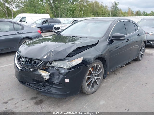 Acura TLX 2015 19UUB3F32FA800561 Image 2
