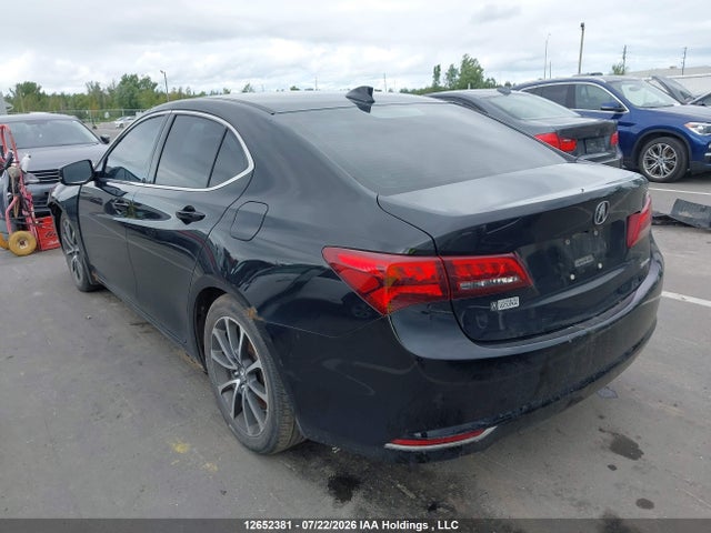Acura TLX 2015 19UUB3F32FA800561 Image 3