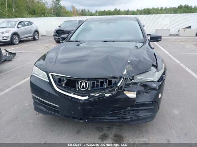 Acura TLX 2015 19UUB3F32FA800561 Image 6