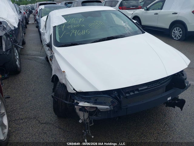 Hyundai Elantra Essential 2024 KMHLM4DG3RU796115 Image 6