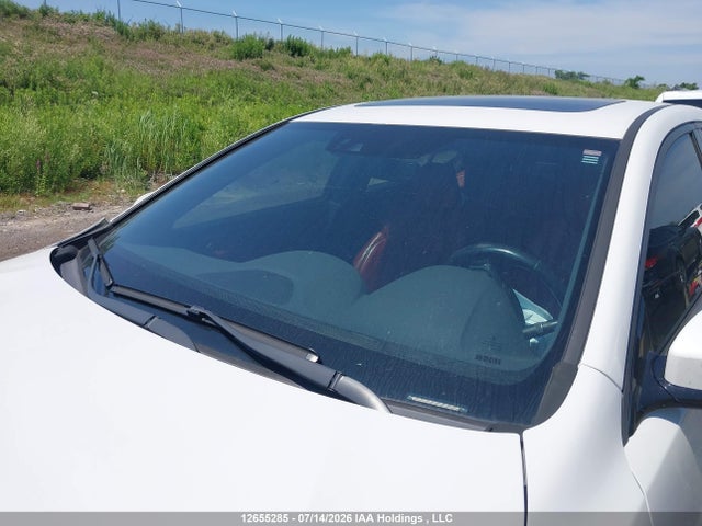 Acura Tlx Technology/a-spec 2019 19UUB3F6XKA802255 Image 17