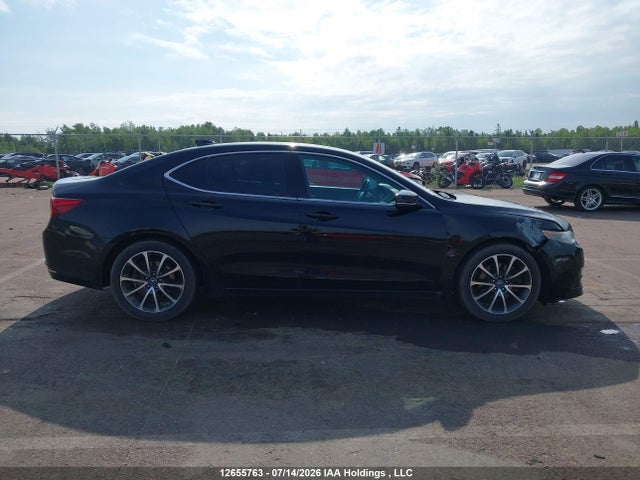Acura TLX TECH 2017 19UUB3F53HA800475 Image 13