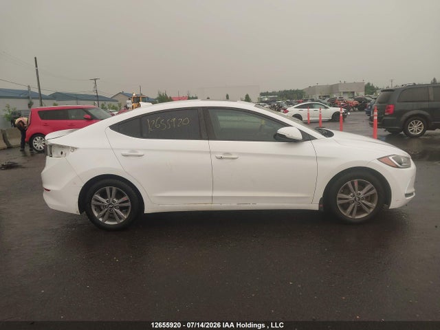 12655920 :رقم المزاد ، KMHD84LF6JU537608 vin ، 2018 Hyundai Elantra Gl Se مزاد بيع