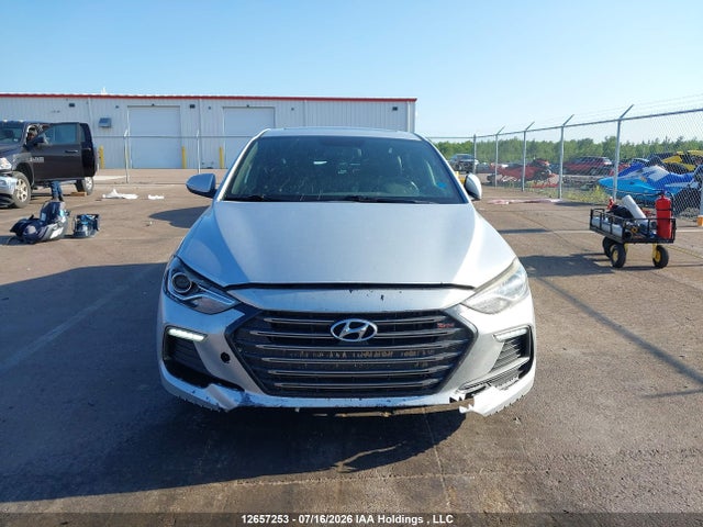 12657253 :رقم المزاد ، KMHD04LB5HU292301 vin ، 2017 Hyundai Elantra Sport مزاد بيع