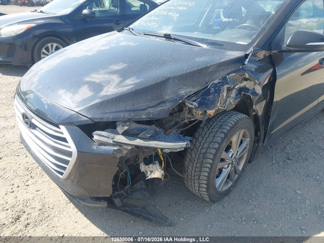12658006 :رقم المزاد ، KMHD84LF0HU375436 vin ، 2017 Hyundai Elantra Se/value/limited مزاد بيع