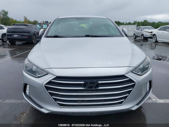 12659818 :رقم المزاد ، KMHD84LF0HU390082 vin ، 2017 Hyundai Elantra Gl مزاد بيع