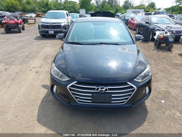 12661143 :رقم المزاد ، KMHD84LF5JU551726 vin ، 2018 Hyundai Elantra Gl مزاد بيع