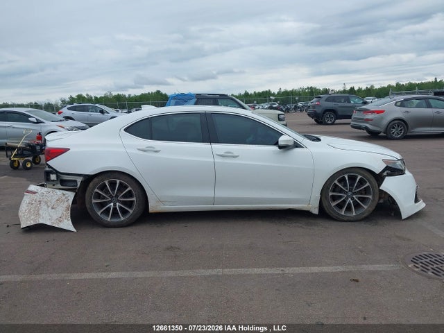 Acura Tlx Advance 2015 19UUB3F71FA800182 Image 14