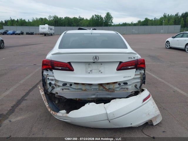 Acura Tlx Advance 2015 19UUB3F71FA800182 Image 17
