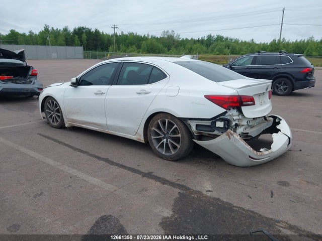 Acura Tlx Advance 2015 19UUB3F71FA800182 Image 3