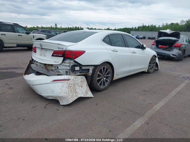 Acura Tlx Advance 2015 19UUB3F71FA800182 Image 4