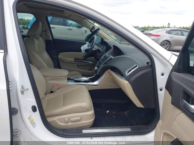 Acura Tlx Advance 2015 19UUB3F71FA800182 Image 5