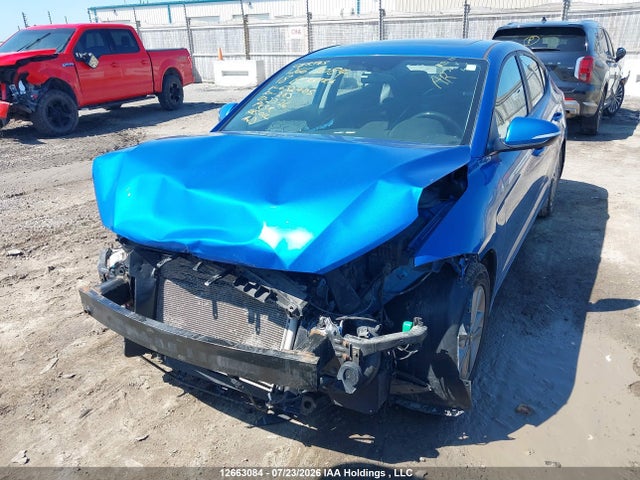 KMHD84LF7JU632405 Hyundai Elantra Sel/value/limited