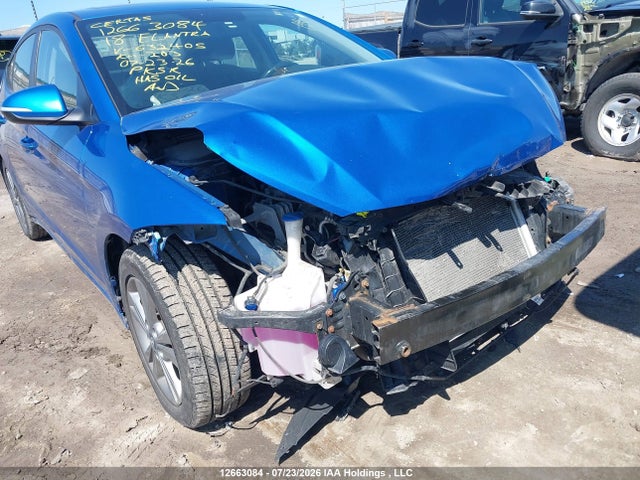 KMHD84LF7JU632405 Hyundai Elantra Sel/value/limited