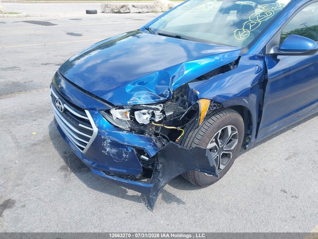 Hyundai Elantra 2017 5NPD74LF8HH135648 Image 6