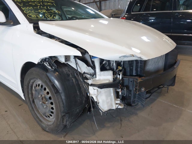 KMHD84LF9JU551261 Hyundai Elantra