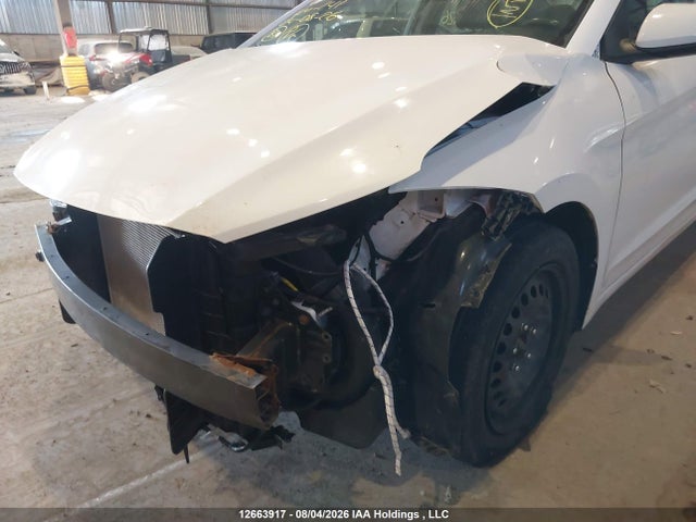 KMHD84LF9JU551261 Hyundai Elantra