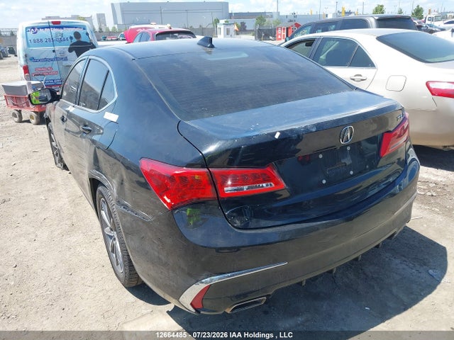 Acura Tlx Technology 2019 19UUB1F51KA800793 Image 3