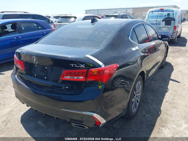 Acura Tlx Technology 2019 19UUB1F51KA800793 Image 4