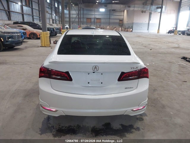 Acura TLX TECH 2017 19UUB3F59HA800481 Image 17