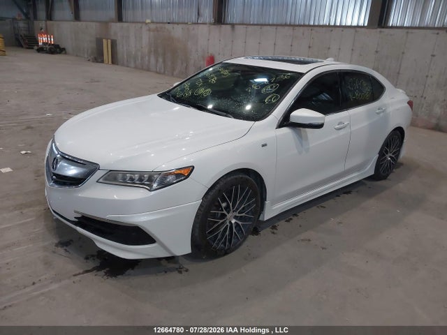 Acura TLX TECH 2017 19UUB3F59HA800481 Image 2