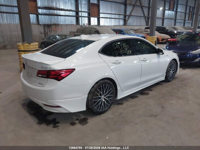 Acura TLX TECH 2017 19UUB3F59HA800481 Image 4