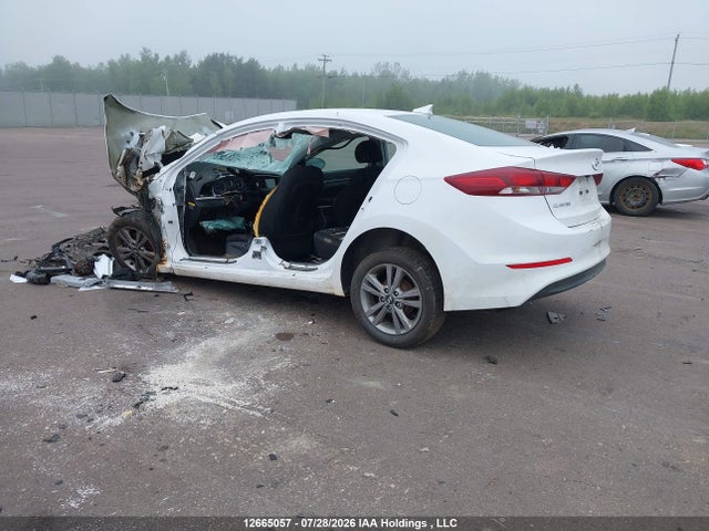 12665057 :رقم المزاد ، KMHD84LF4HU322643 vin ، 2017 Hyundai Elantra Se/value/limited مزاد بيع