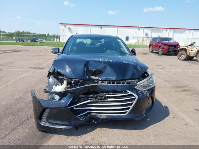 12643878 :رقم المزاد ، KMHD84LF5HU232658 vin ، 2017 Hyundai Elantra Gls مزاد بيع