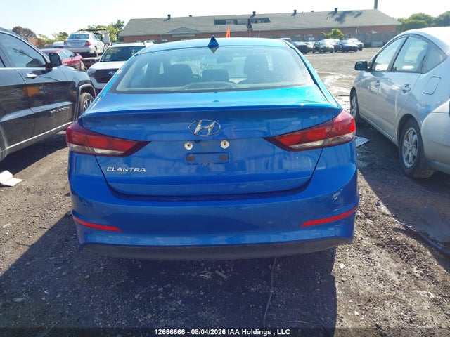 KMHD84LF6JU479662 Hyundai ELANTRA GL