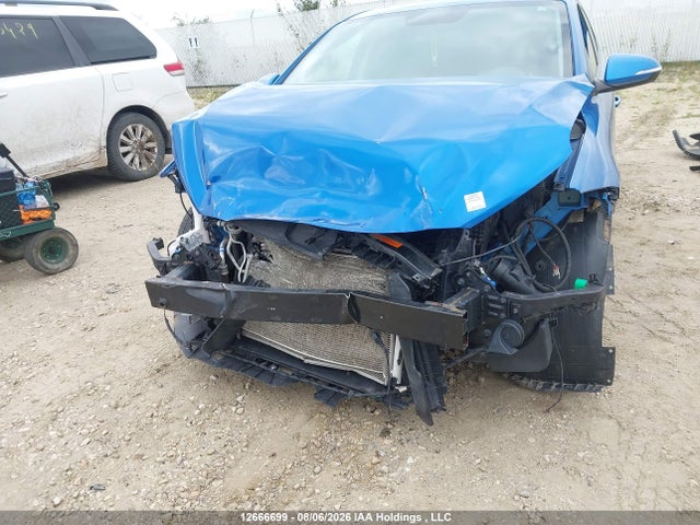KMHD84LF9HU266019 Hyundai Elantra Gls