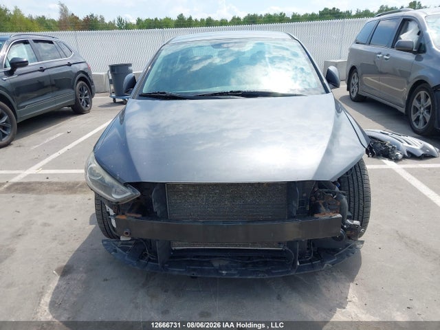 KMHD84LF3HU094621 Hyundai ELANTRA GL