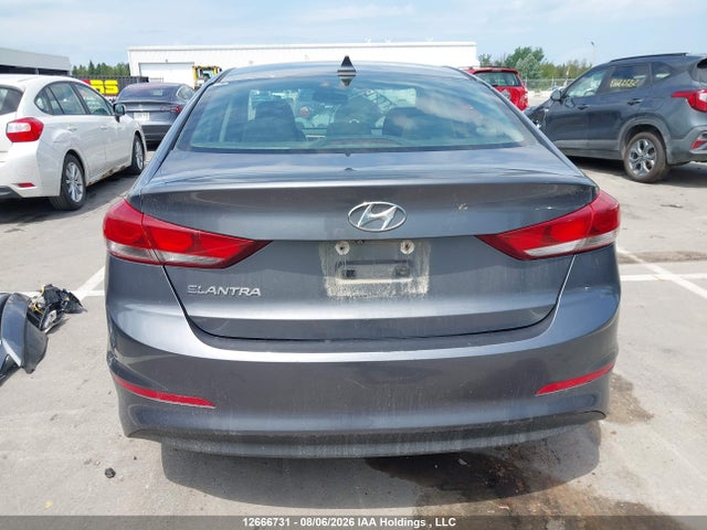 KMHD84LF3HU094621 Hyundai ELANTRA GL