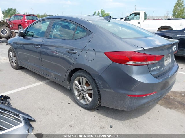 KMHD84LF3HU094621 Hyundai ELANTRA GL