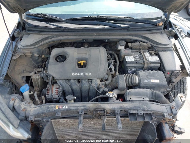 KMHD84LF3HU094621 Hyundai ELANTRA GL