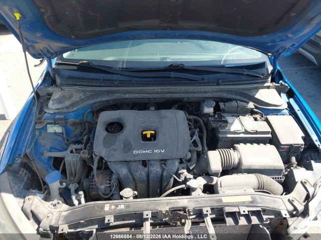 KMHD84LF9JU518230 Hyundai ELANTRA GL