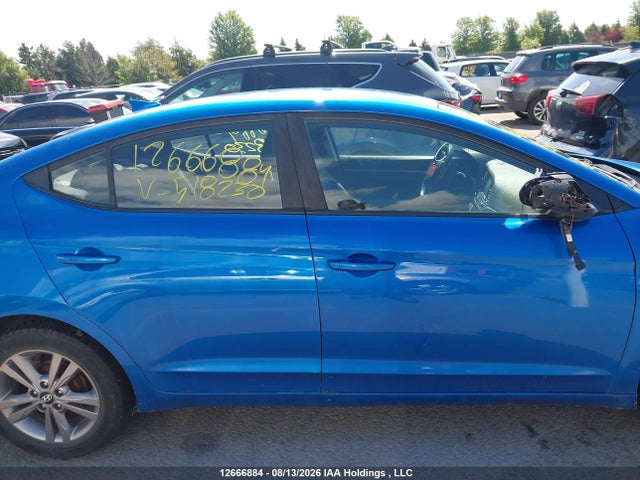 KMHD84LF9JU518230 Hyundai ELANTRA GL