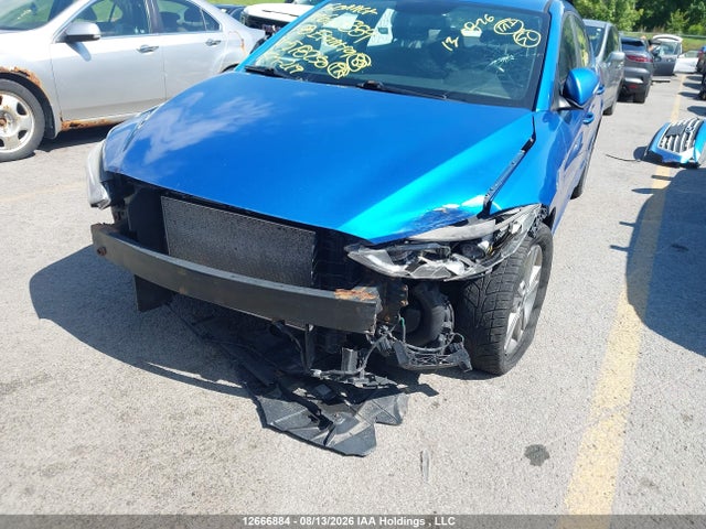 KMHD84LF9JU518230 Hyundai ELANTRA GL