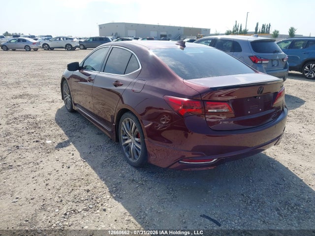 Acura Tlx Advance 2015 19UUB3F74FA801830 Image 3