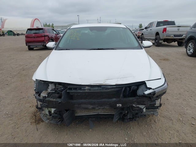 KMHLM4DG1RU685336 Hyundai ELANTRA SEL