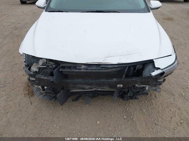 KMHLM4DG1RU685336 Hyundai ELANTRA SEL