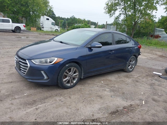 12672860 :رقم المزاد ، KMHD84LF8JU467979 vin ، 2018 Hyundai Elantra Gl Se مزاد بيع