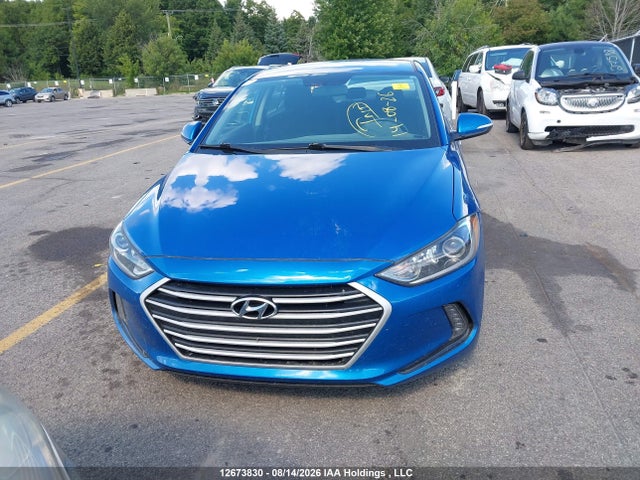 KMHD84LF6JU703058 Hyundai ELANTRA GL