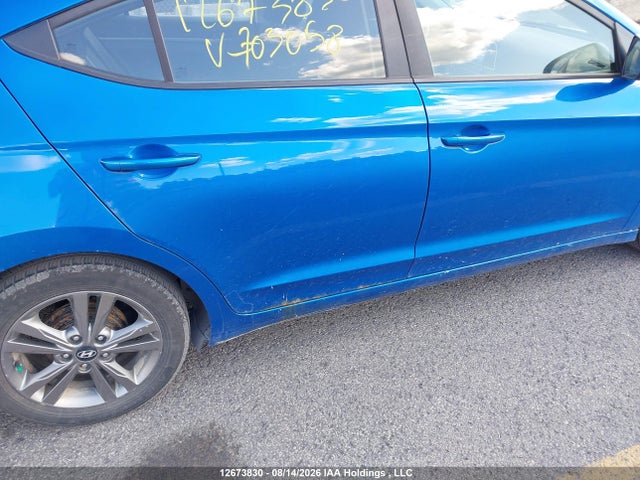 KMHD84LF6JU703058 Hyundai ELANTRA GL