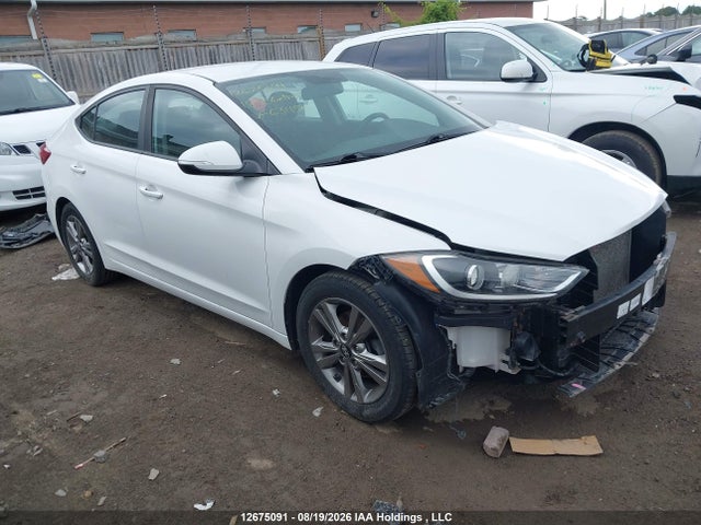 2018 KMHD84LF6JU631150 main image